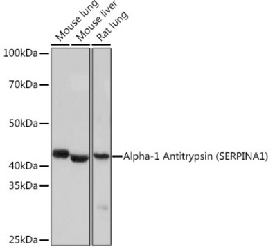 Anti-Alpha-1 Antitrypsin (SERPINA1) Antibody, clone 1J3E7, Rabbit Monoclonal