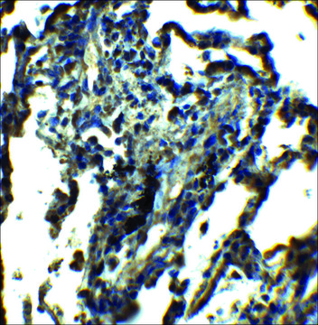 Anti-NDFIP1 antibody produced in rabbit affinity isolated antibody, buffered aqueous solution