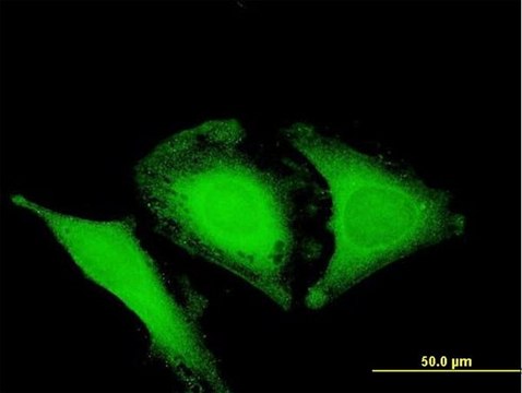 Anti-OPTN antibody produced in mouse purified immunoglobulin, buffered aqueous solution