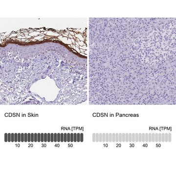 Anti-CDSN antibody produced in rabbit Prestige Antibodies&#174; Powered by Atlas Antibodies, affinity isolated antibody, buffered aqueous glycerol solution