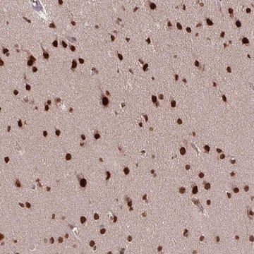 Anti-SS18 antibody produced in rabbit Prestige Antibodies&#174; Powered by Atlas Antibodies, affinity isolated antibody, buffered aqueous glycerol solution