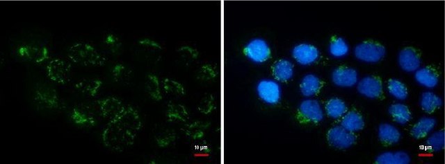 Monoclonal Anti-COL11A2 antibody produced in mouse clone GT473, affinity isolated antibody