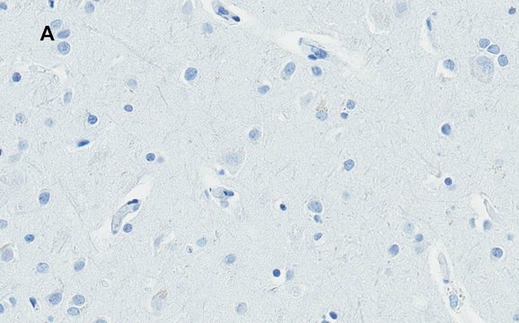 Anti-Huntingtin Protein Antibody, clone 1M11, ZooMAb&#174; Rabbit Monoclonal recombinant, expressed in HEK 293 cells