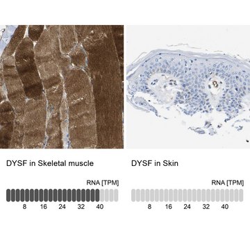 Anti-DYSF antibody produced in rabbit Prestige Antibodies&#174; Powered by Atlas Antibodies, affinity isolated antibody, buffered aqueous glycerol solution