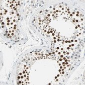 Anti-MLLT10 antibody produced in rabbit Prestige Antibodies® Powered by Atlas Antibodies, affinity isolated antibody, buffered aqueous glycerol solution