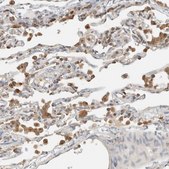 Anti-RAB11FIP1 antibody produced in rabbit Prestige Antibodies&#174; Powered by Atlas Antibodies, affinity isolated antibody, buffered aqueous glycerol solution, Ab1
