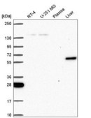 Anti-TOE1 antibody produced in rabbit Prestige Antibodies® Powered by Atlas Antibodies, affinity isolated antibody