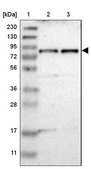 Anti-TYW1B antibody produced in rabbit Prestige Antibodies® Powered by Atlas Antibodies, affinity isolated antibody, buffered aqueous glycerol solution