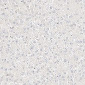 Anti-FHOD1 antibody produced in rabbit Prestige Antibodies® Powered by Atlas Antibodies, affinity isolated antibody, buffered aqueous glycerol solution