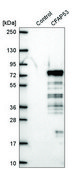 Anti-CFAP53 antibody produced in rabbit Prestige Antibodies® Powered by Atlas Antibodies, affinity isolated antibody, buffered aqueous glycerol solution