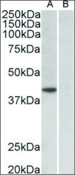 Anti-TBP antibody produced in goat affinity isolated antibody, buffered aqueous solution