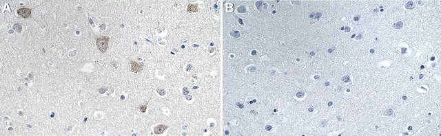 Anti-MBNL1 Antibody, clone 1H11 ZooMAb&#174; Rabbit Monoclonal recombinant, expressed in HEK 293 cells