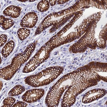 Anti-FBXW5 antibody produced in rabbit Prestige Antibodies&#174; Powered by Atlas Antibodies, affinity isolated antibody, buffered aqueous glycerol solution