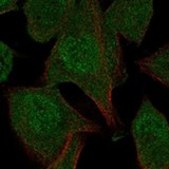 Anti-N4BP2 antibody produced in rabbit Prestige Antibodies® Powered by Atlas Antibodies, affinity isolated antibody, buffered aqueous glycerol solution