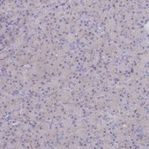 Anti-ANK2 antibody produced in rabbit Prestige Antibodies® Powered by Atlas Antibodies, affinity isolated antibody, buffered aqueous glycerol solution
