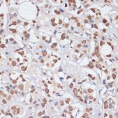 Anti-PCNA antibody produced in rabbit