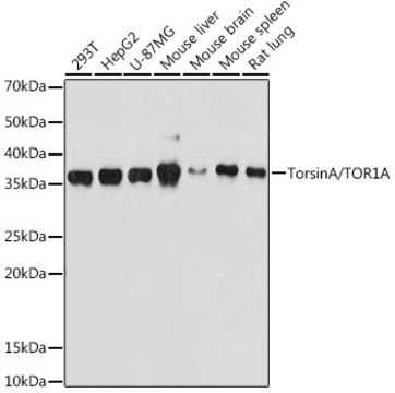 Anti-TorsinA/TOR1A Antibody, clone 4Q2I9, Rabbit Monoclonal