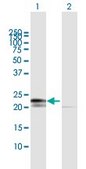 Anti-RPL29 antibody produced in mouse IgG fraction of antiserum, buffered aqueous solution