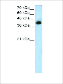 Anti-MTUS1 antibody produced in rabbit IgG fraction of antiserum