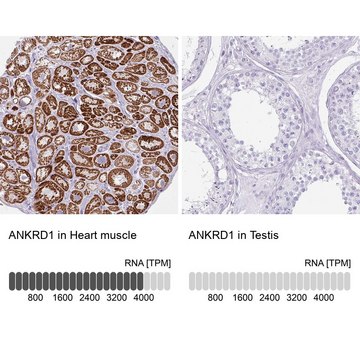 Anti-ANKRD1 antibody produced in rabbit Prestige Antibodies&#174; Powered by Atlas Antibodies, affinity isolated antibody, buffered aqueous glycerol solution