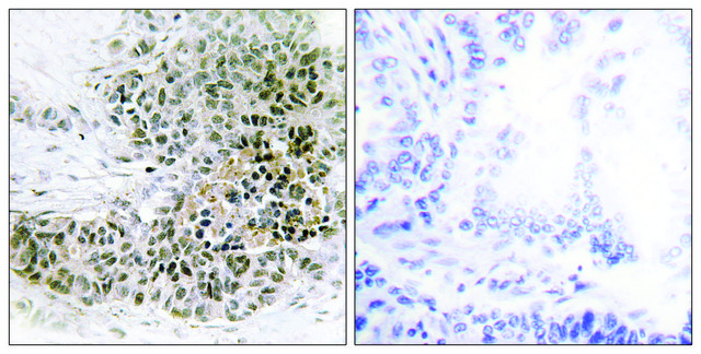 抗-TRPS1 兔抗 affinity isolated antibody