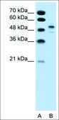 Anti-POU3F2 (AB2) antibody produced in rabbit affinity isolated antibody