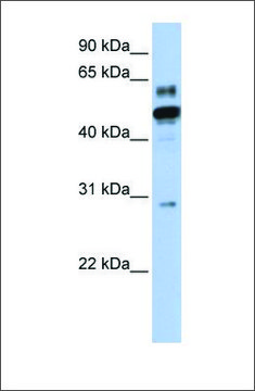 Anti-ESRRA antibody produced in rabbit affinity isolated antibody