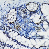 Anti-SATB2 antibody produced in rabbit