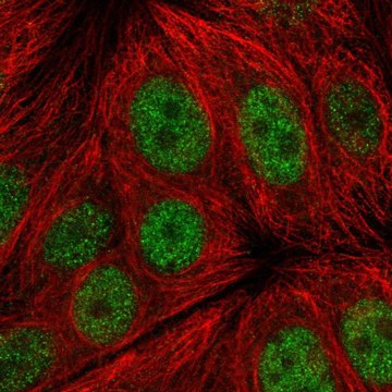 Anti-C14orf1 antibody produced in rabbit Prestige Antibodies&#174; Powered by Atlas Antibodies, affinity isolated antibody