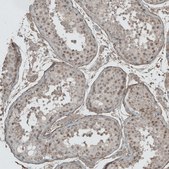 Anti-L1TD1 antibody produced in rabbit Prestige Antibodies® Powered by Atlas Antibodies, affinity isolated antibody, buffered aqueous glycerol solution, ab1