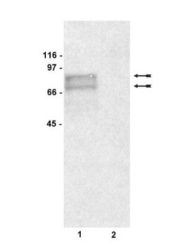 Anti-Tyrosinase Antibody, clone T311 clone T311, Upstate&#174;, from mouse