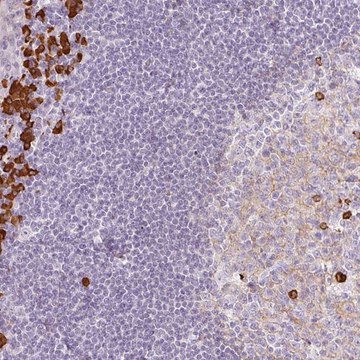 Anti-PRPF38B antibody produced in rabbit Prestige Antibodies&#174; Powered by Atlas Antibodies, affinity isolated antibody, buffered aqueous glycerol solution