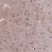 Anti-CDK18 antibody produced in rabbit Prestige Antibodies® Powered by Atlas Antibodies, affinity isolated antibody, buffered aqueous glycerol solution