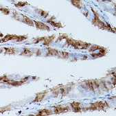 Anti-Phospho-Erk1-T202/Y204 + Erk2-T185/Y187 antibody produced in rabbit