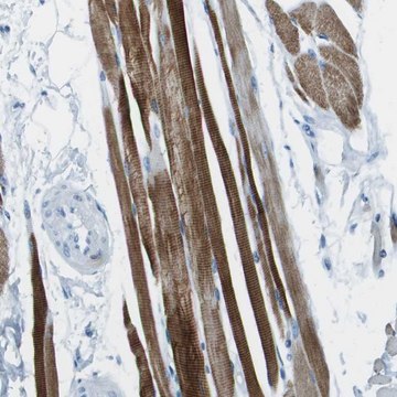 Anti-SLC16A10 antibody produced in rabbit Prestige Antibodies&#174; Powered by Atlas Antibodies, affinity isolated antibody, buffered aqueous glycerol solution