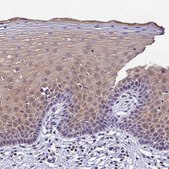 Anti-CARS2 antibody produced in rabbit Prestige Antibodies® Powered by Atlas Antibodies, affinity isolated antibody, buffered aqueous glycerol solution