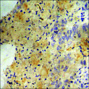 Anti-phospho-PKD1/PKC mu (pTyr463) antibody produced in rabbit affinity isolated antibody