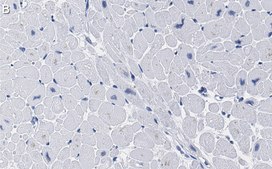 Anti-SDHB Antibody, clone 1H11 ZooMAb&#174; Rabbit Monoclonal recombinant, expressed in HEK 293 cells