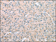 Anti-WDR5 affinity isolated antibody
