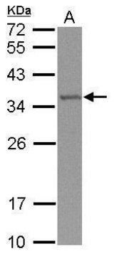 Anti-TRMT61A antibody produced in rabbit affinity isolated antibody, buffered aqueous solution