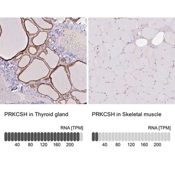 Anti-PRKCSH antibody produced in rabbit Prestige Antibodies&#174; Powered by Atlas Antibodies, affinity isolated antibody, buffered aqueous glycerol solution