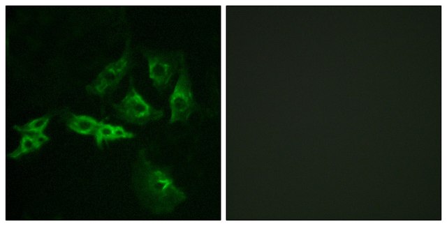 Anti-GNRHR antibody produced in rabbit affinity isolated antibody