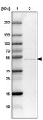 Anti-ZDHHC1 antibody produced in rabbit Prestige Antibodies® Powered by Atlas Antibodies, affinity isolated antibody, buffered aqueous glycerol solution