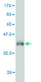 Monoclonal Anti-PGRMC2 antibody produced in mouse clone 3C11, purified immunoglobulin, buffered aqueous solution