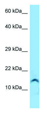 Anti-GUCA2A antibody produced in rabbit affinity isolated antibody