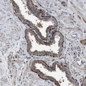 Anti-PCOLCE2 antibody produced in rabbit Prestige Antibodies® Powered by Atlas Antibodies, affinity isolated antibody, buffered aqueous glycerol solution
