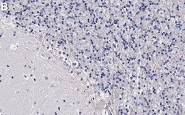 Anti-GABRB2 Antibody, clone BD17 ZooMAb&#174; Mouse Monoclonal recombinant, expressed in HEK 293 cells