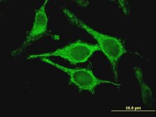 Monoclonal Anti-CLIC5 antibody produced in mouse clone 1E6, purified immunoglobulin, buffered aqueous solution