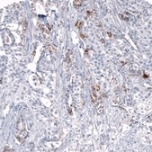 Anti-L1CAM antibody produced in mouse Prestige Antibodies® Powered by Atlas Antibodies, clone CL12984, purified by using Protein A, buffered aqueous glycerol solution