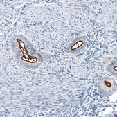 Monoclonal Anti-MUC1 antibody produced in mouse Prestige Antibodies® Powered by Atlas Antibodies, clone CL8733, purified immunoglobulin, buffered aqueous glycerol solution